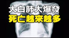 [ID: GFet5nxwo0k] Youtube Automatic