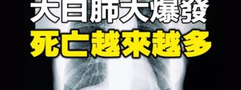 [ID: GFet5nxwo0k] Youtube Automatic